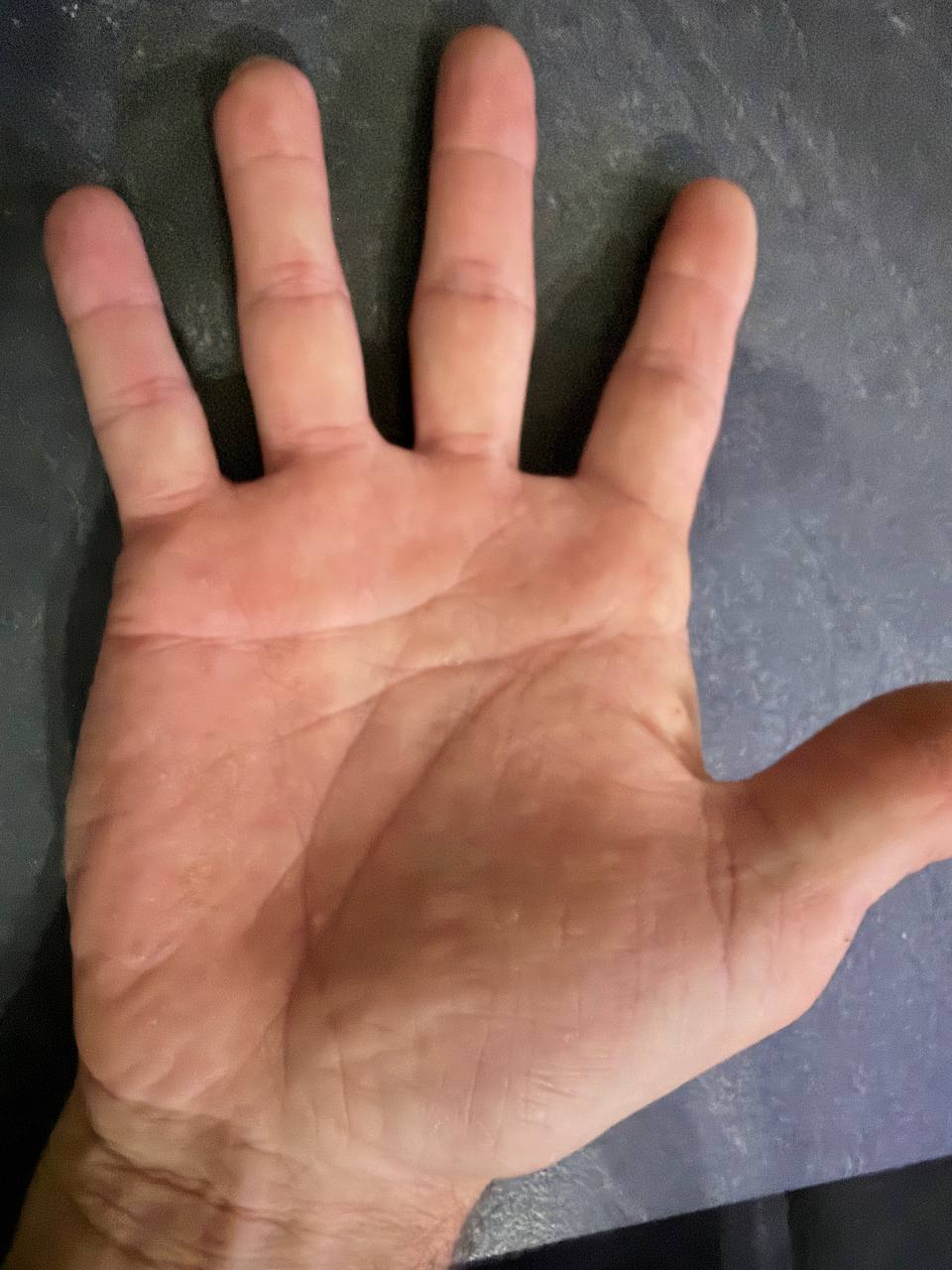 Rechte Handfl&auml;che, flach und gut ausgeleuchtet fotografiert